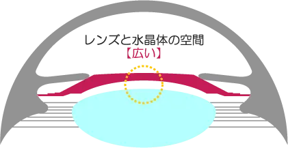 レンズと水晶体の空間
