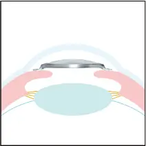 レンズ固定イメージ